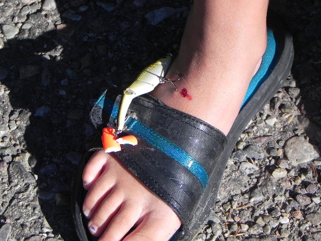 hook in the foot