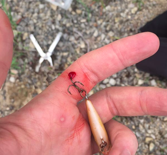 fish hook hand