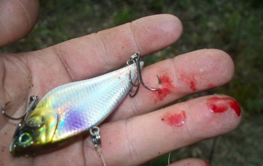artificial lure hook stuck in hand