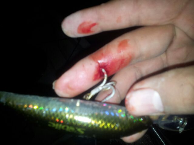 hook in finger
