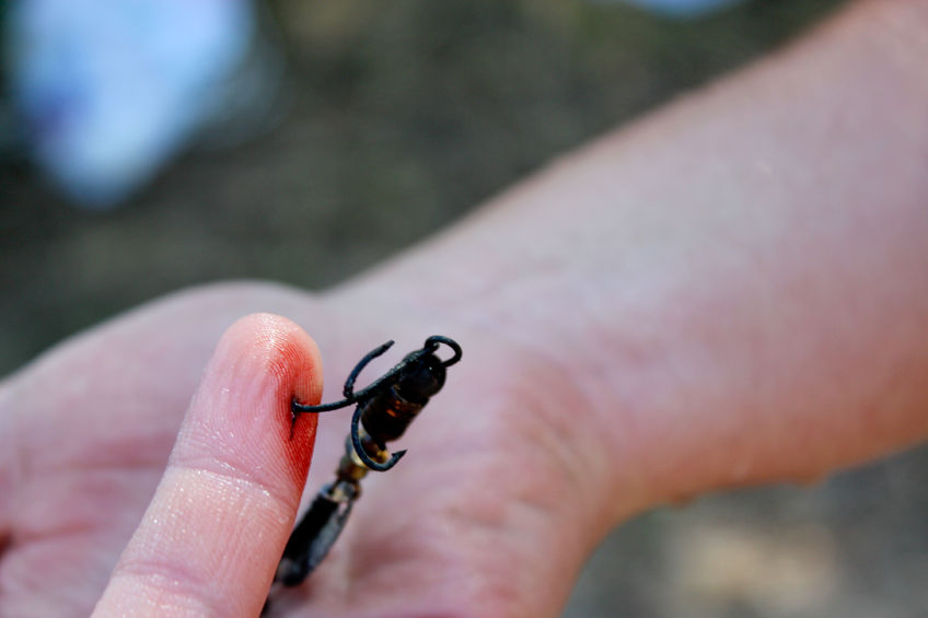 fishing hook in finger