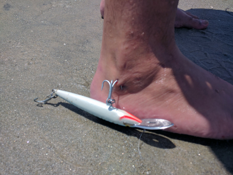 hook stuck in foot
