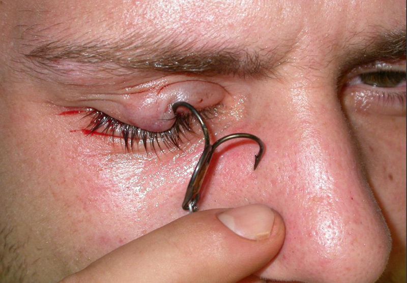 treble hook in the eye