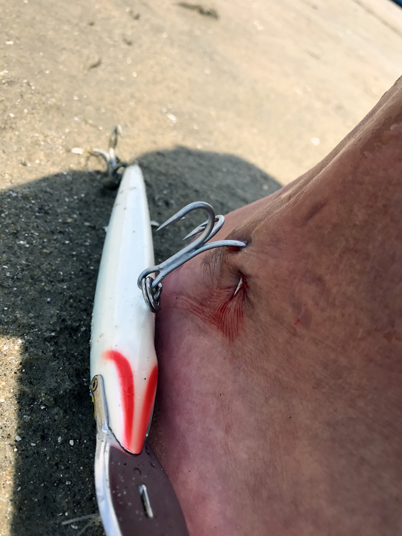 hook in the foot