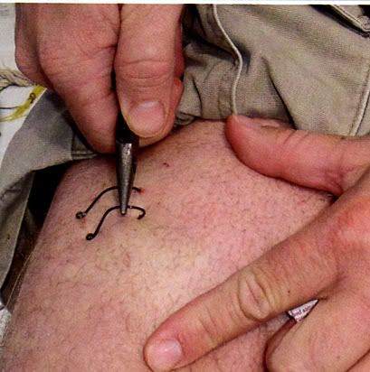 fish hook stuck in leg