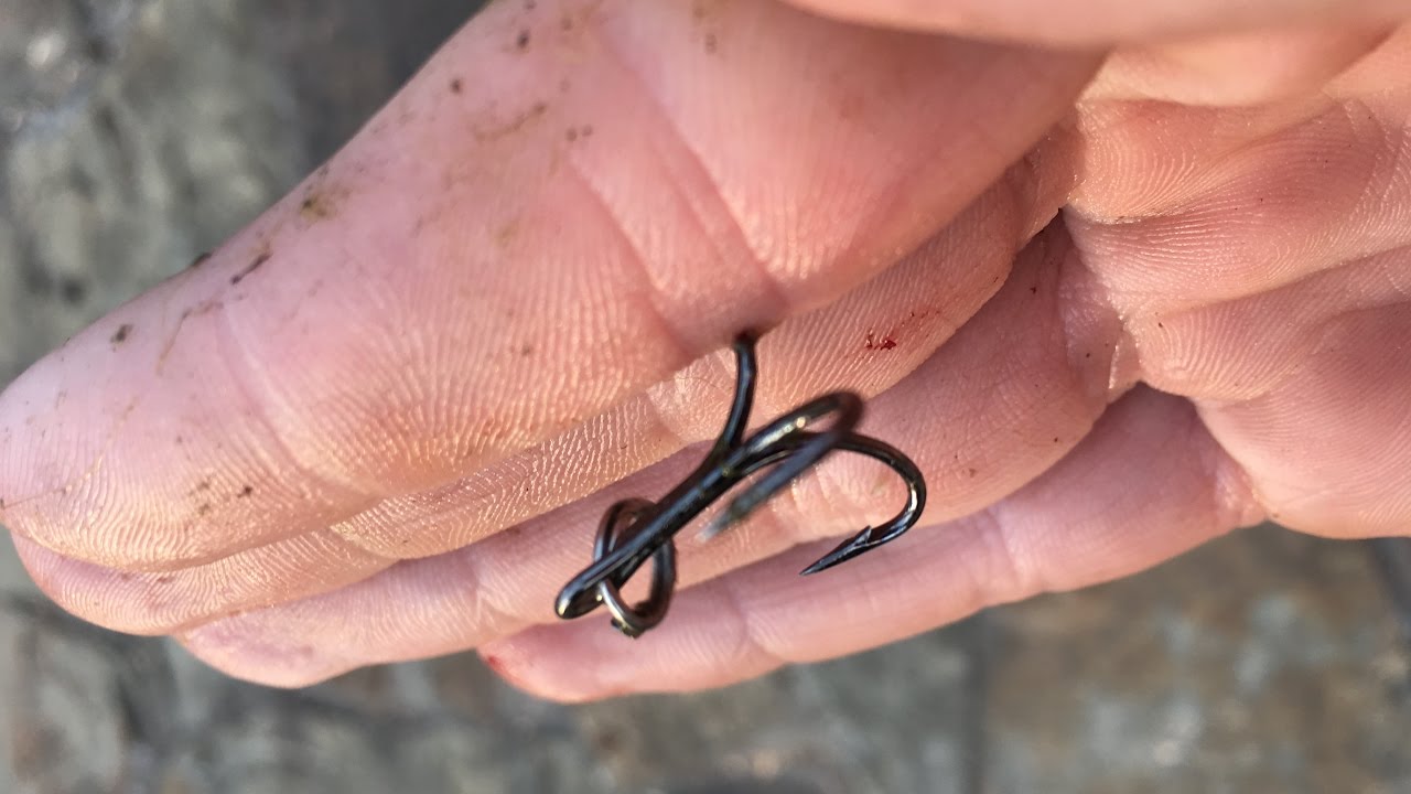 fishing hook stuck in finger
