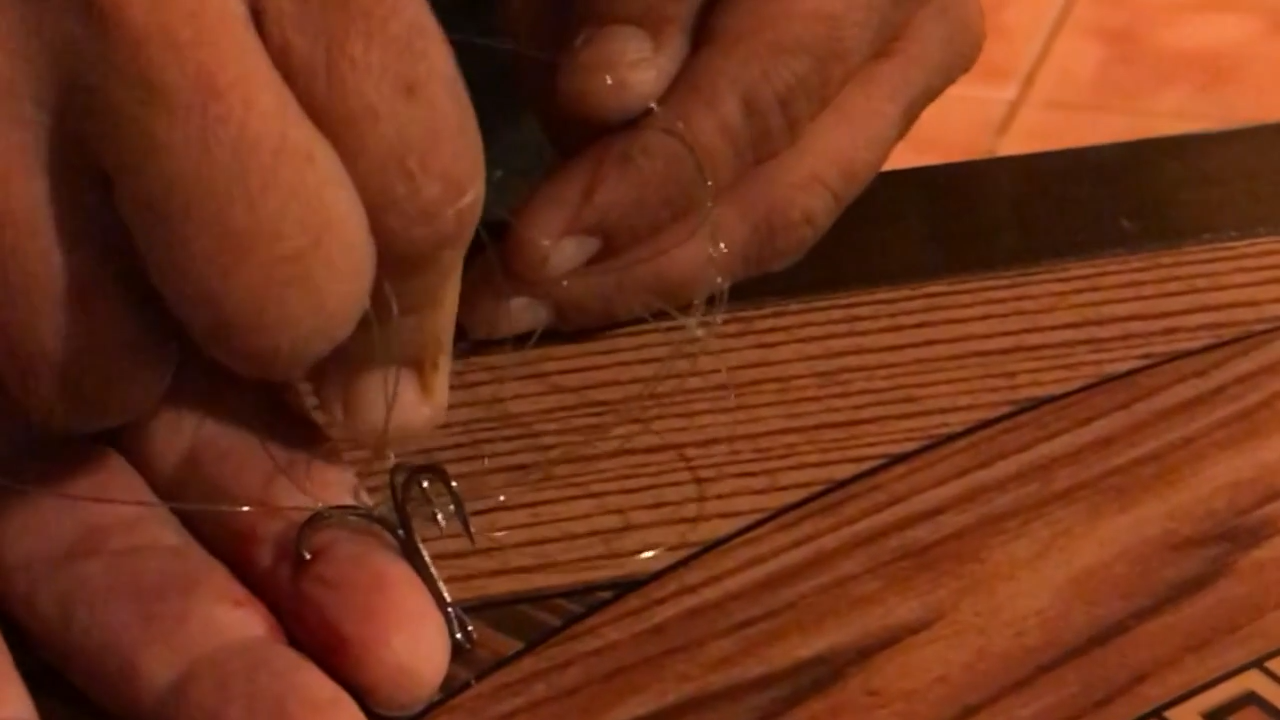 fish hook in the finger
