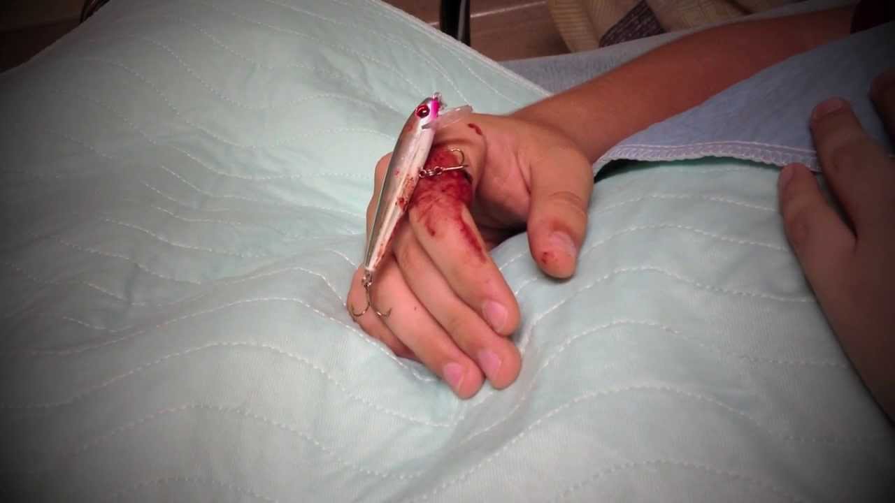 hook in hand