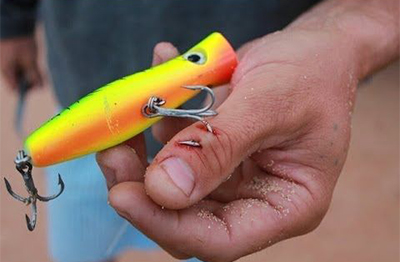 treble hook in the thumb