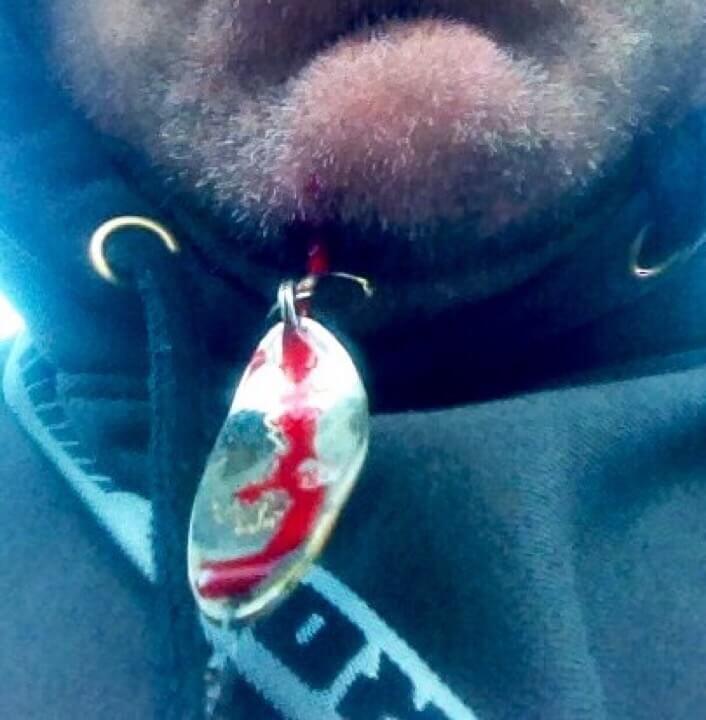 hook in chin