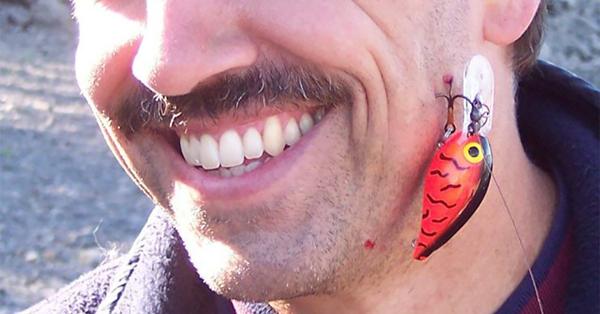 http://fish%20hook%20stuck%20in%20your%20face%20hand
