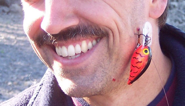 fish hook stuck in cheek