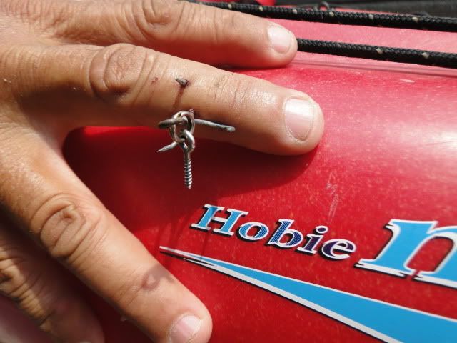 fishing hook in the finger