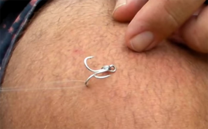 hook in the thigh