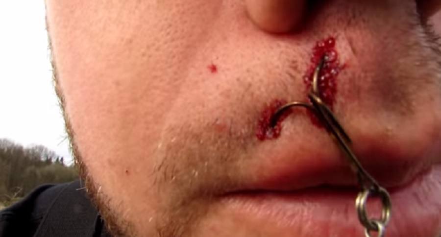 treble hook in your face