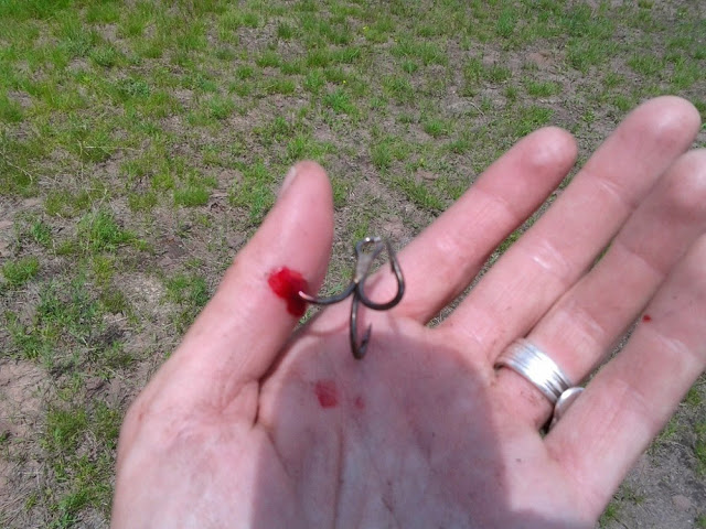 treble hook in thumb